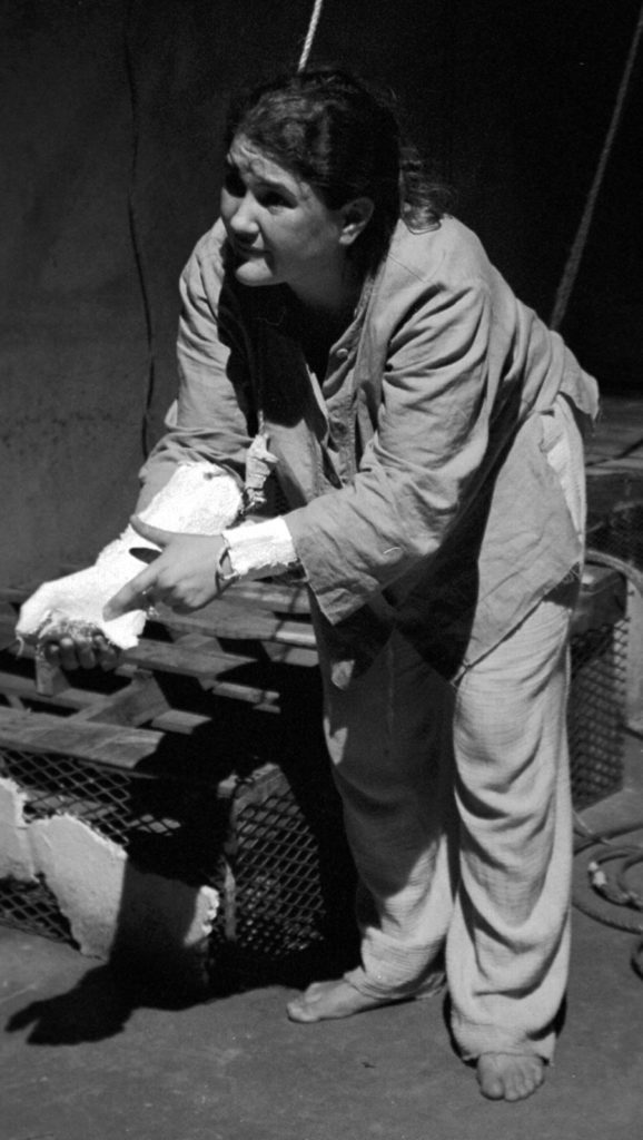 A woman bent over in supplication and wearing a plaster cast begs for money.