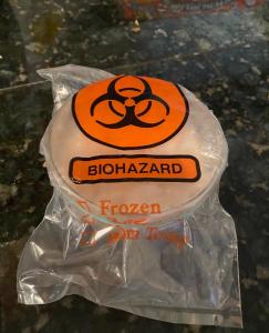 Something inside a bag labeled BIOHAZARD! on a speckled counter.